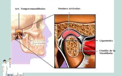 Alteraciones de la Articulación Témporomandibular.